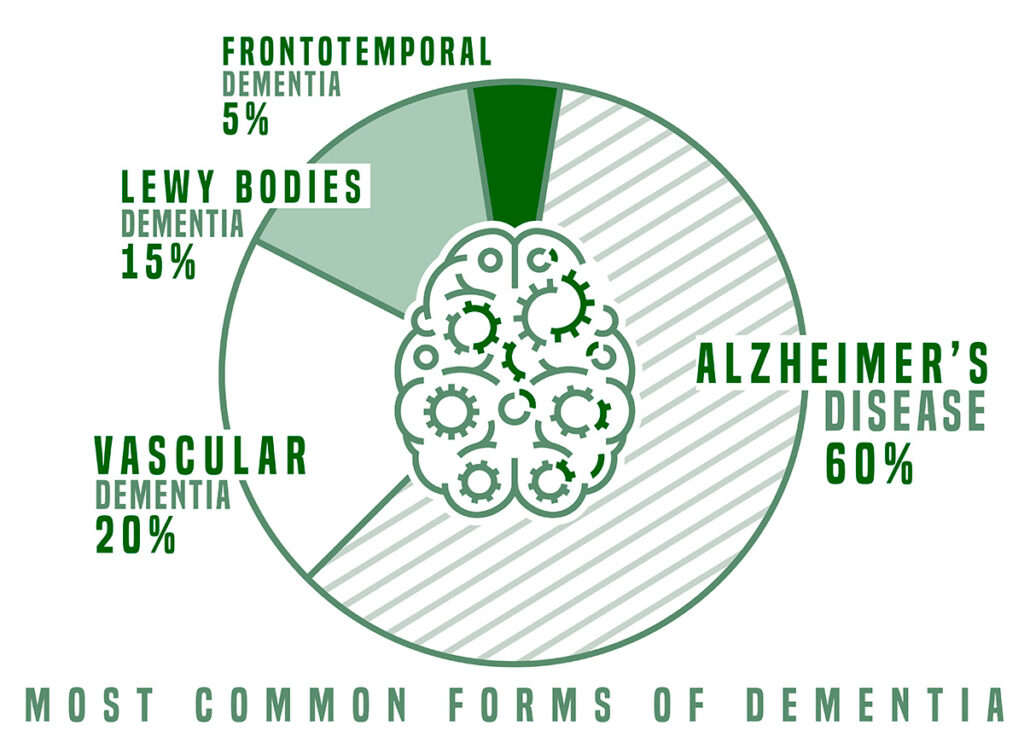 Frontotemporal Dementia Eyes: How Does Dementia Affect the Eyes?