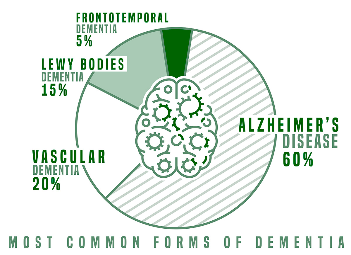 Types of Dementia - Frontotemporal dementia eyes - The Breckinridge Memory Care - Lexington, KY